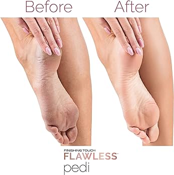 FLAWLESS PEDI ELECTRONIC PEDICURE